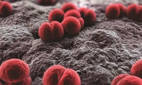 Viêm màng não mô cầu "sát thủ 24 giờ", bác sĩ cảnh báo nguy cơ