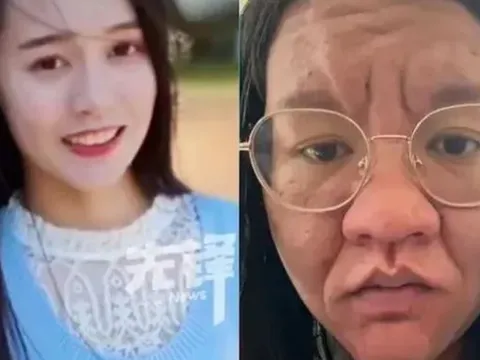 Người phụ nữ gây sốc vì gương mặt như bà lão khi mang thai