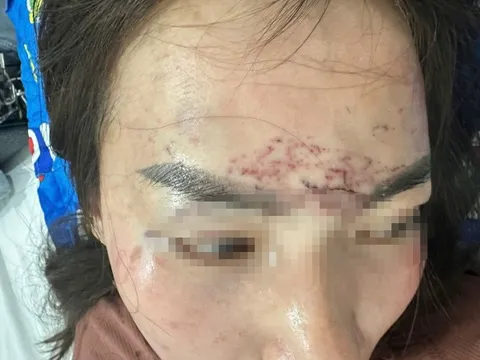 Diễn biến mới vụ người phụ nữ bị cắt tóc, xăm mặt ở Cà Mau