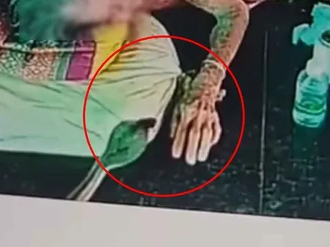 Đang nằm trên giường, cụ bà 93 tuổi bất ngờ bị rắn hổ mang cắn vào tay