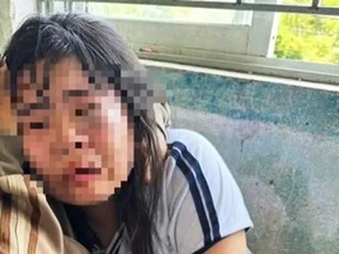 Nữ sinh lớp 7 bị 2 nam sinh lớp 9 đánh nhập viện